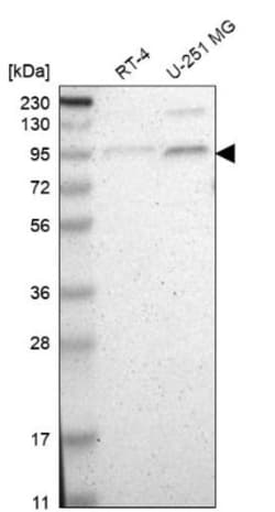 Myotubularin Antibody, Novus Biologicals:Antibodies:Primary Antibodies